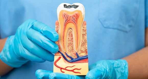 A person wearing blue gloves is holding a detailed model of a tooth anatomy, showing the layers and structure including the pulp and nerves.